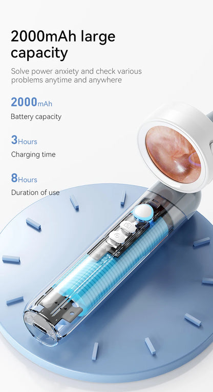 1.38'' Ear Camera Wit IPS Display and 1080P Camera Ear Check Portable Inspector for Ear Mouth Pet With 12tips Replaceable Tools