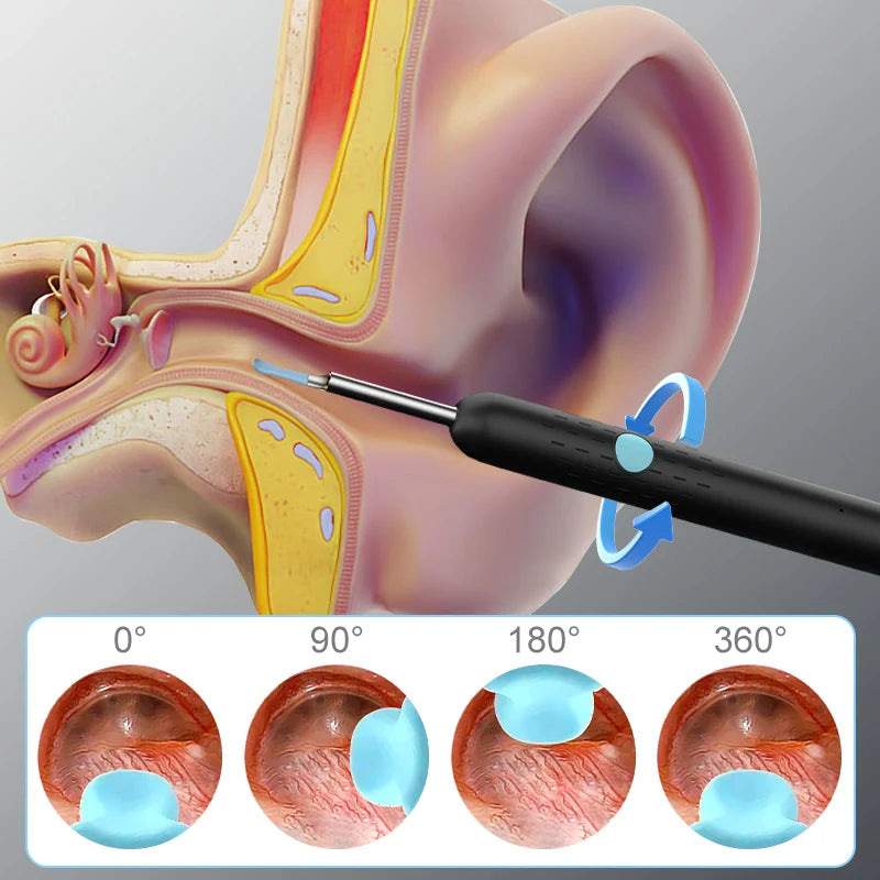 WIFI Visual Ear Sticks HD1080P 4.2MM Mini Otoscope Camera Ear pick Ear Cleaner Wireless Endoscope Health Care Ear Wax Cleaning