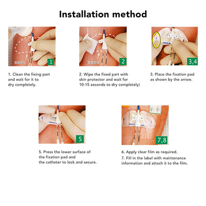 Catheter Tube Holder Catheter Stabilization Device PU Disposable Butterfly Shape Adhesive Urinary Legband Sticker