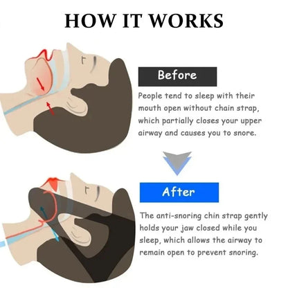 1/2/4pcs Anti-snoring Mouthpieces Chin Strap Sleep Care Breathable and Comfortable Anti Snore Belt for Men Women Daily Sleeping