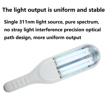 311nm Ultraviolet Phototherapy Instrument Double Lamp UVB Lamp for Vitiligo Treatment Psoriasis Lamp Skin Disease Device