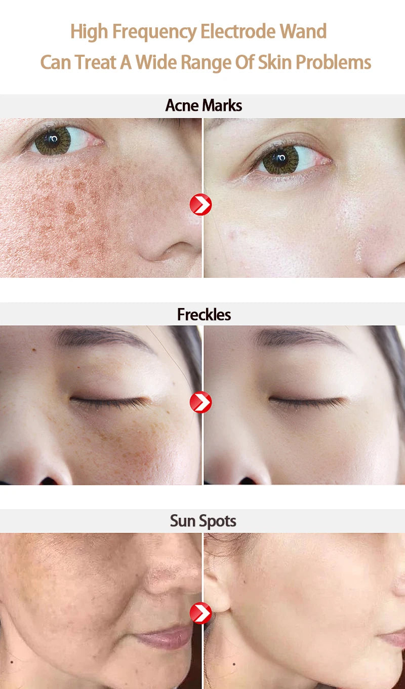 Replace HF Wand Spiral Electrode Glass Tube Argon Violet Ray Neon Acne Skin Care Face Body Massage