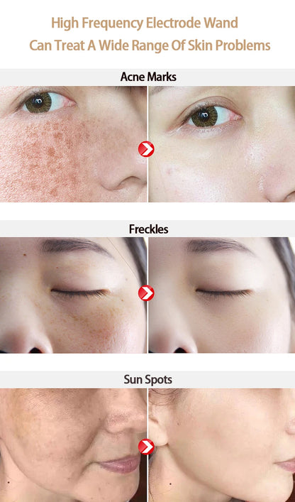 Replace HF Wand Spiral Electrode Glass Tube Argon Violet Ray Neon Acne Skin Care Face Body Massage