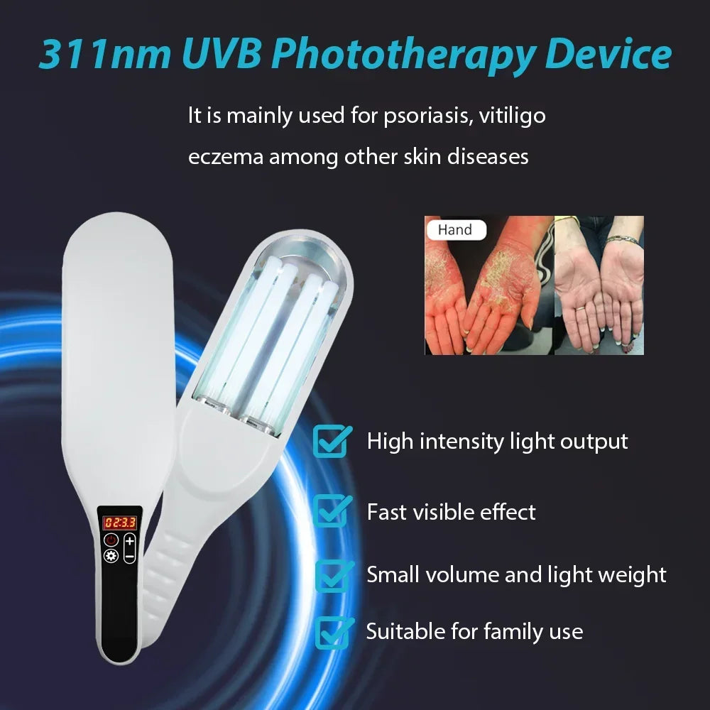 311nm Ultraviolet Phototherapy Instrument Double Lamp UVB Lamp for Vitiligo Treatment Psoriasis Lamp Skin Disease Device