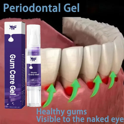 Damaged Gum Repair Care Gel Relieve Sore Gums Allergy Deep Cleaning Teeth Stains Tartar Serum Dental Caries Toothpaste