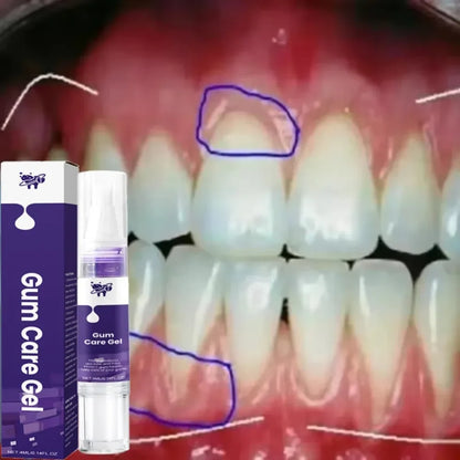 Damaged Gum Repair Care Gel Relieve Sore Gums Allergy Deep Cleaning Teeth Stains Tartar Serum Dental Caries Toothpaste