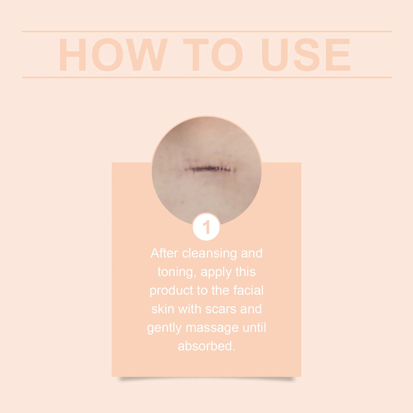 Centella Asiatica Scar Solution Stick Repair Blemishes Reduce Scar Visibility Restore Surface Barrier Portable Scar Repair Gel