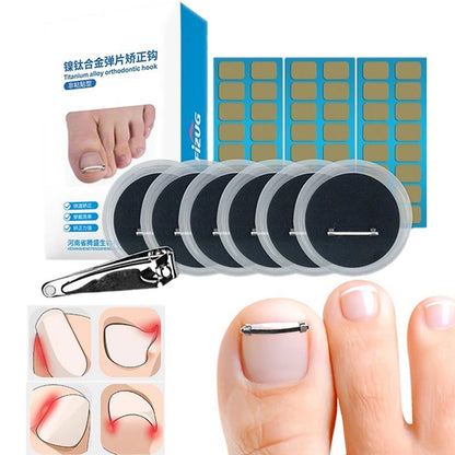 Ingrown Toenail Pedicure Tool Embed Toe Nail Care Straightening Correction Clip Curved Clamp Toenails Correction Tool For Toes