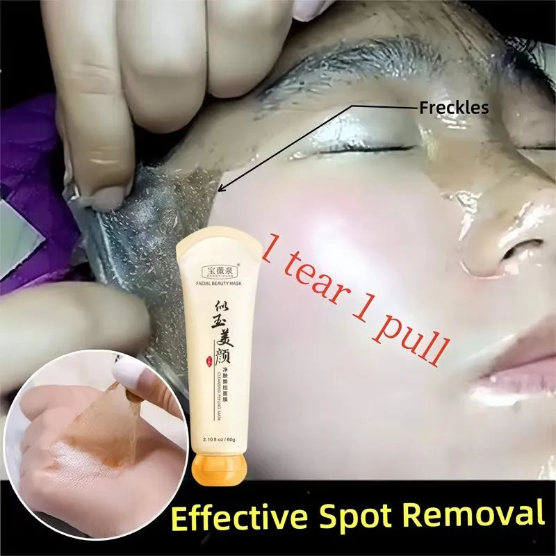 Peel Off Instant Freckle Removal Mask Effective Treatment Chloasma Pigmentation Acne Scars Dark Spots Facial Skin Care Products