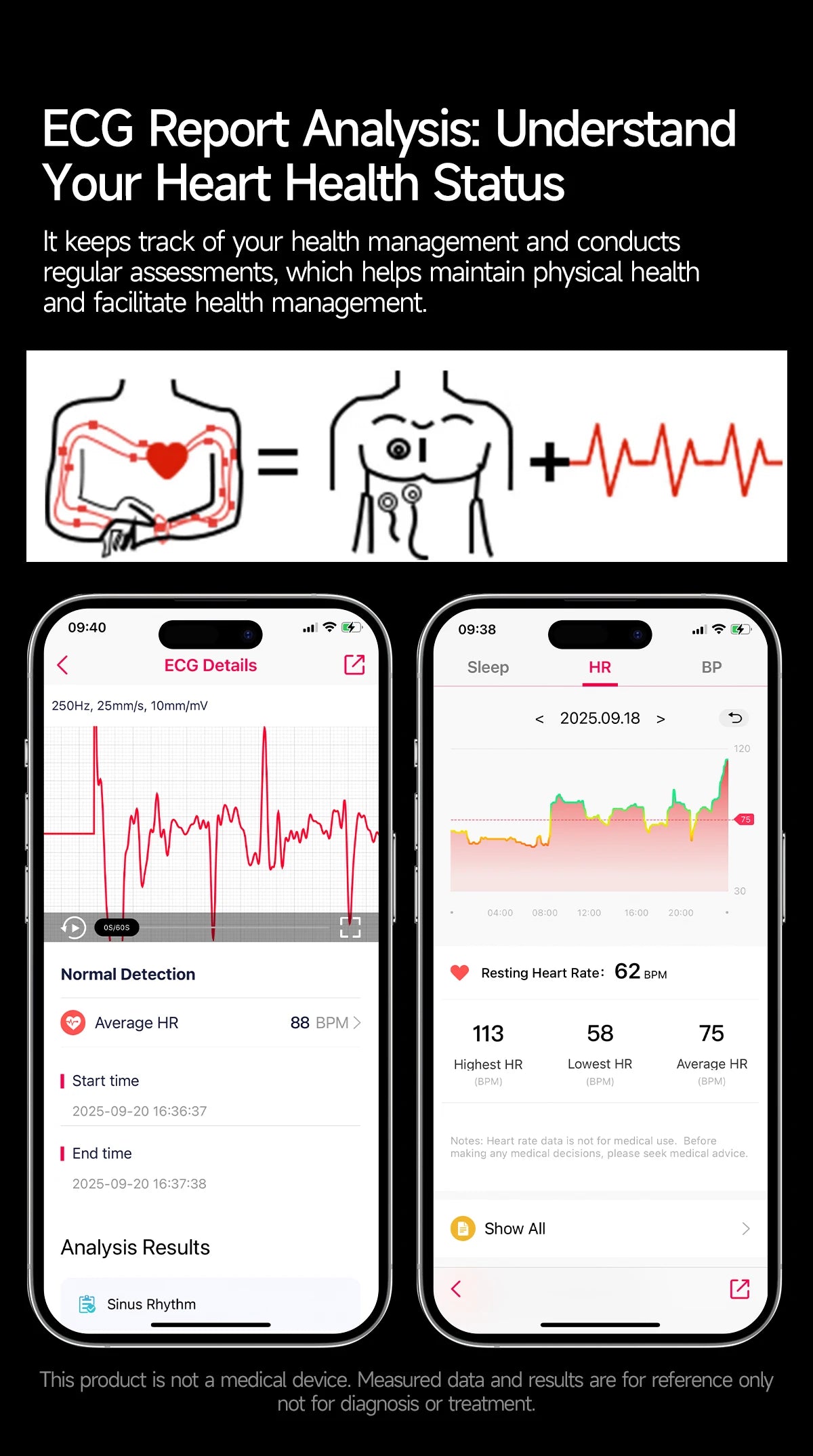 2026New Nursing Grade Health Smartwatches For Men Women Precision Detection Heart Rate Blood Fats Uric Acid ECG+PPG Smart Watch