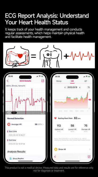 2026New Nursing Grade Health Smartwatches For Men Women Precision Detection Heart Rate Blood Fats Uric Acid ECG+PPG Smart Watch