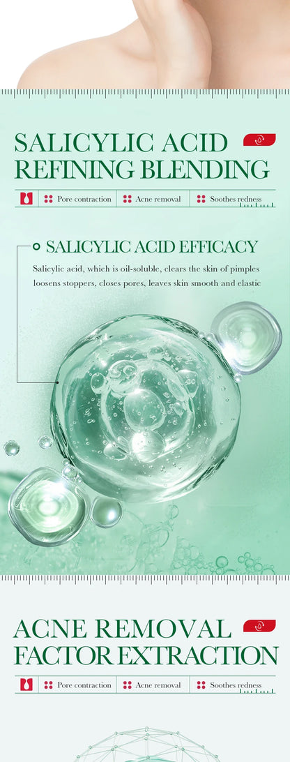 35ml BIOAOUA Salicylic Acid Anti-Acne Removal Essence Regulate Oil Secretion Improve Acne Of Skin Smooth Skin Blackhead Removal
