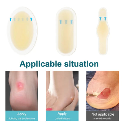 24 5pcs Adhesive Hydrocolloid Gel Blister Plaster Heel Anti-wearing Heel Sticker Pedicure Patch Plaster Foot Care Tools