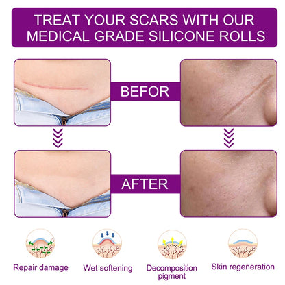 1.5M Silicone Scar Sheets Clear Scars Tape Strip Invisible Silicone Self-adhesive Patches for C-Section Surgery Keloid Burn Acne