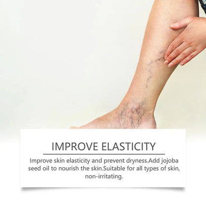 Natural Ingredients Vein Relief Cream for Legs Soothes Aching Varicose Veins Alleviates Swelling - Home Use for Leg Vein Health