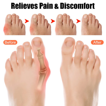 10/20PCS Precut Kinesiology Tape for Bunion,Bunion Corrector & Relief,Big Toe Support Pain Relief,Hypoallergenic Latex-Free Tape