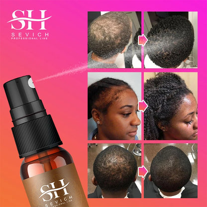 10ml Chebe Spray Fast Hair Growth Oil Hair Loss Treatment Traction Alopecia Spray Repair Damage Anti Hair Break Hair Care Spray