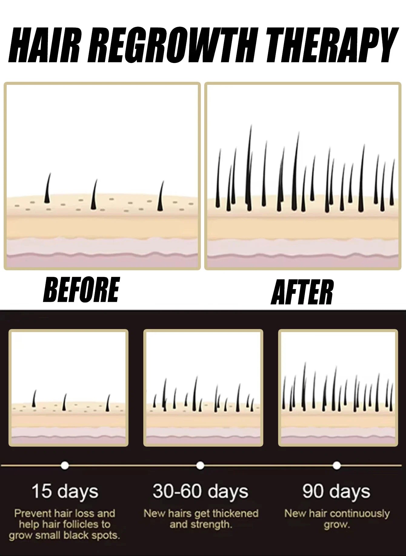 2026 Latest Technology New Products Anti-Hair Loss Essence Promotes Hair Growth and Improves the Scalp Environment