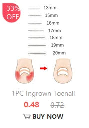 2/6/12Pc Ingrown Toenail Toe Correction Stickers Nail Art Foot Patches Feet Care Paronychia Treatment Recover Pedicure Foot Tool