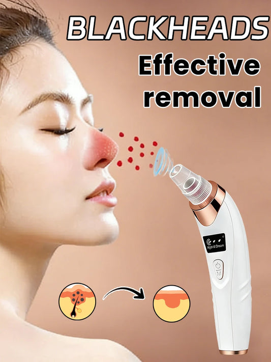 Electric Blackhead Remover Vacuum Cleaner Black Dots Vacuum Cleaner Skin Pimple Acne Extractor Facial Cleaning Electric