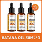Lewedo Naturals Batana Oil Fast Hair Growth for Men Women Pure Batana Oil Nourish Shiny Hair Healthy Hair Care Anti Hair Loss