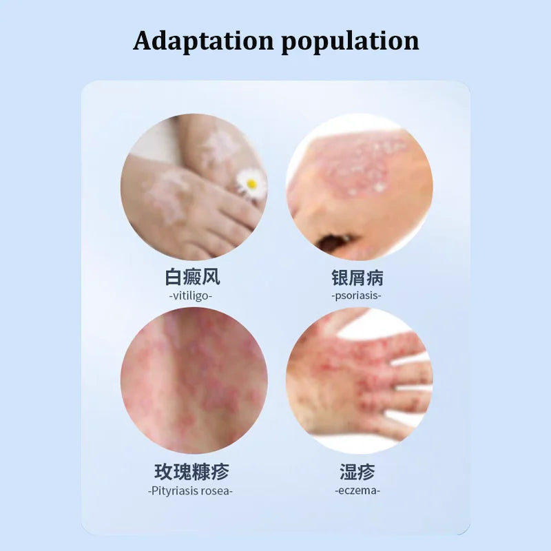 311NM UVB Phototherapy Lamp Device for Vitiligo Treatment UV NarrowBand Ultraviolet Light Therapy Psoriasis Spots Eczema