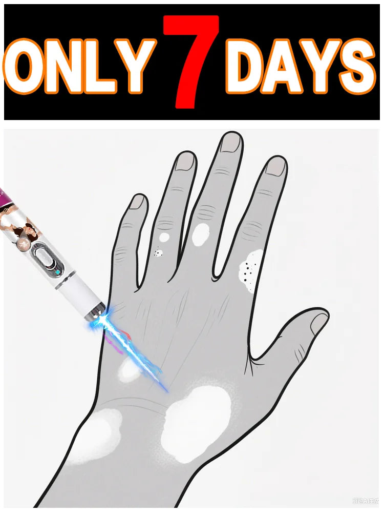 Vitiligo Treatment Device 2nd Upgraded Version⸴Vitiligo Treatment⸴Fast