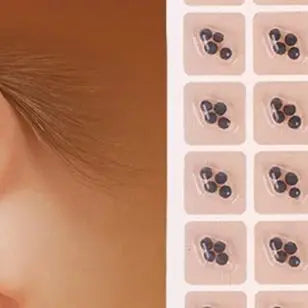 400patches Ear Care Seeds Acupuncture Auricular Disposable Ear Stickers Massage Therapy Needle Patch Auricular Auriculotherapy