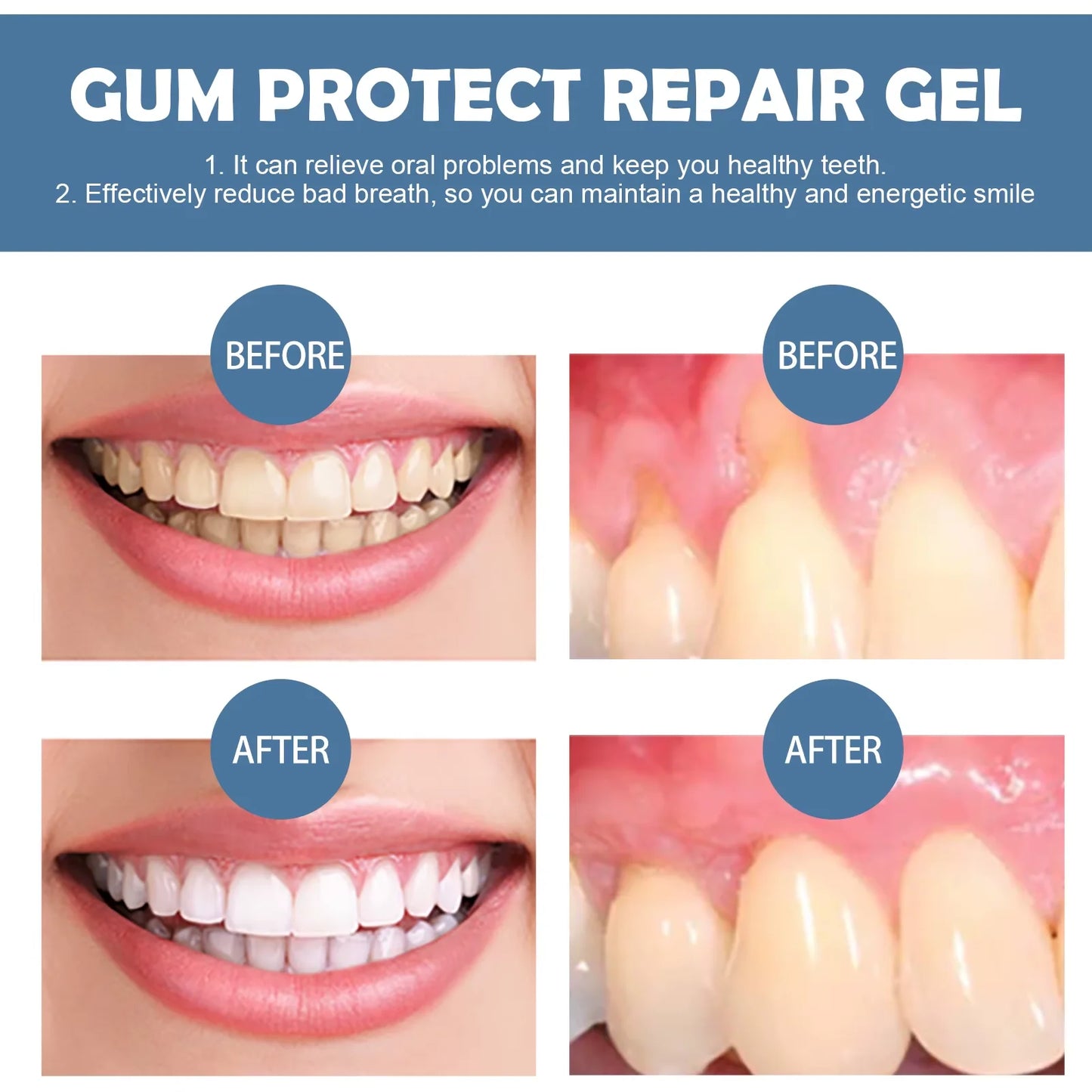 3-Pack Dental Repair Gel Relieves Inflamed Gums and Deep Clean Tooth Dirt Care Reduces Bad Breath Gums Fresh Breath Care Gel