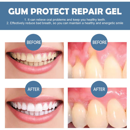 3-Pack Dental Repair Gel Relieves Inflamed Gums and Deep Clean Tooth Dirt Care Reduces Bad Breath Gums Fresh Breath Care Gel