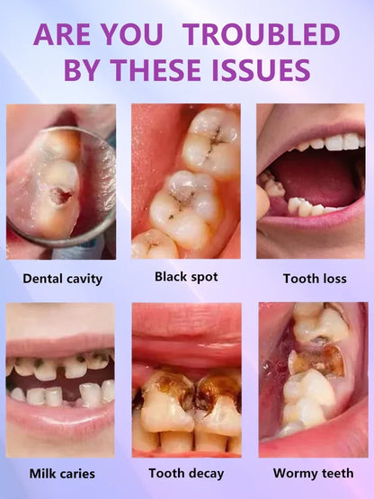 Tooth decay Repair Repairing Cavities Protecting Anti Caries