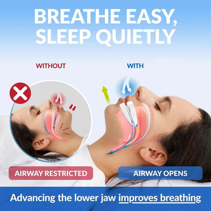 Adjustable Anti-Snoring Mouthpiece Nighttime Teeth Guard Sleeping Mouthguard for Bruxism Stop Snoring Device