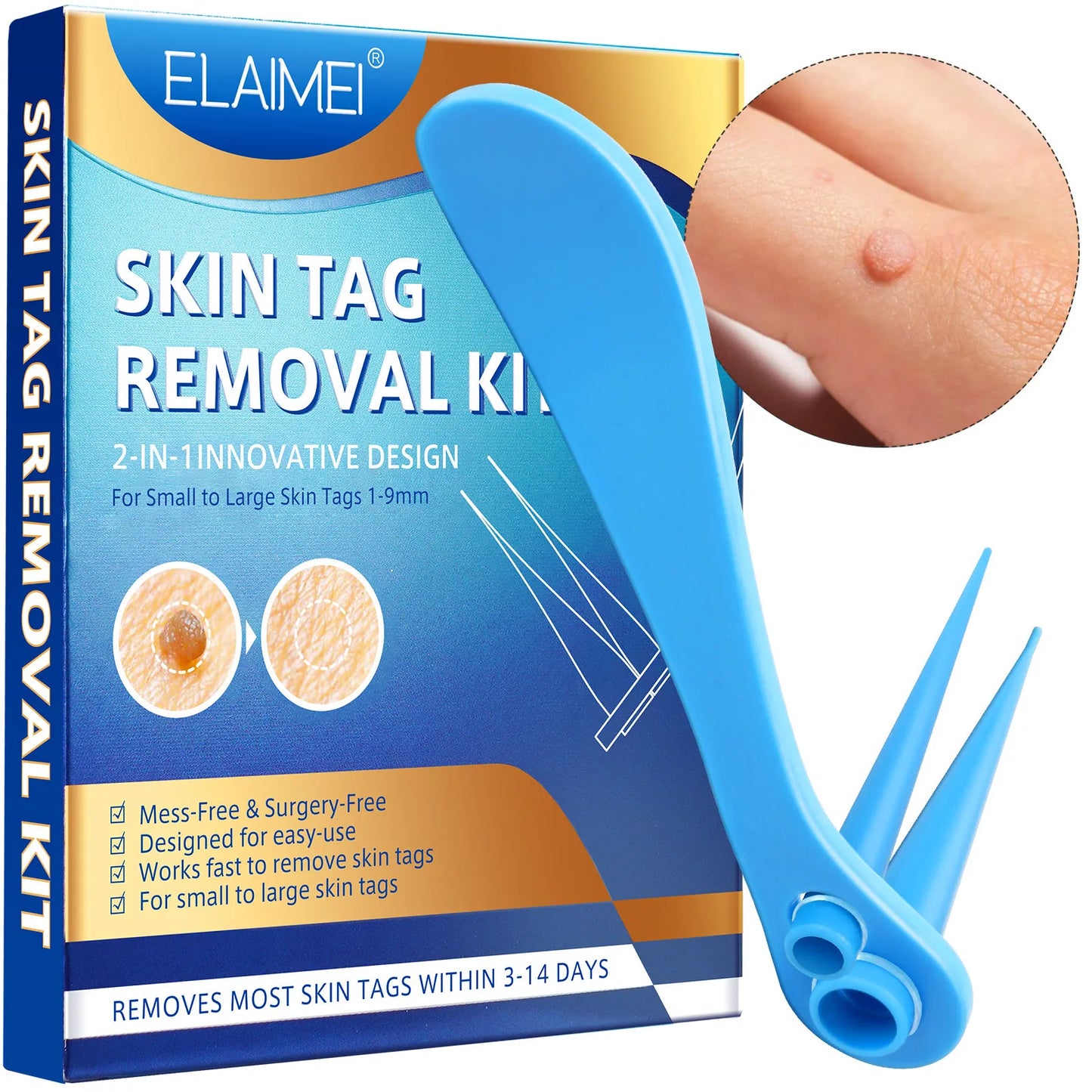 2-IN-1 Innovative Skin Tag Remover Kit Micro Skin Tag Removal Device Adult Mole Stain Wart Remover Face Care Beauty Tools