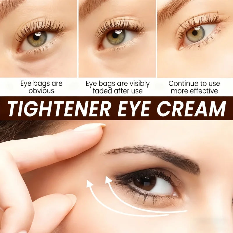 Botax Eye Cream 24H Lifting - Anti-Aging Formula with Vitamin C, Retinol & Bee Venom for Firm, Smooth & Youthful Skin.