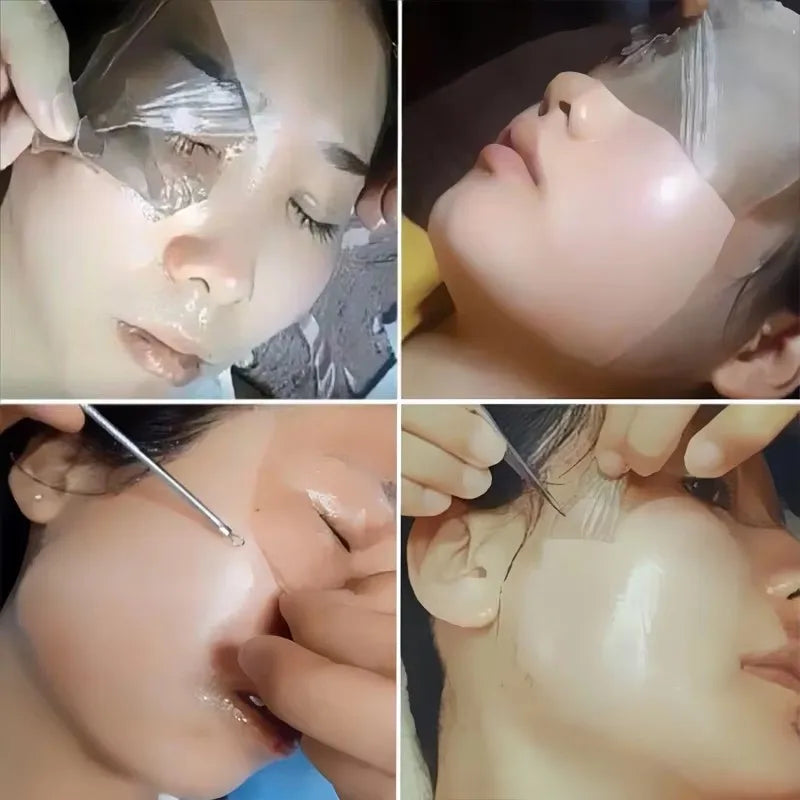 Peel Off Instant Freckle Removal Mask Effective Treatment Chloasma Pigmentation Acne Scars Dark Spots Facial Skin Care Products