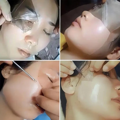 Peel Off Instant Freckle Removal Mask Effective Treatment Chloasma Pigmentation Acne Scars Dark Spots Facial Skin Care Products
