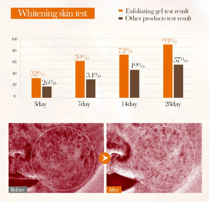 Face Exfoliating Gel Deep Cleansing Pores,Remove Dead Skin Purify Gentle Exfoliate Oil Control Moisturizing Face Scrub Skin Care