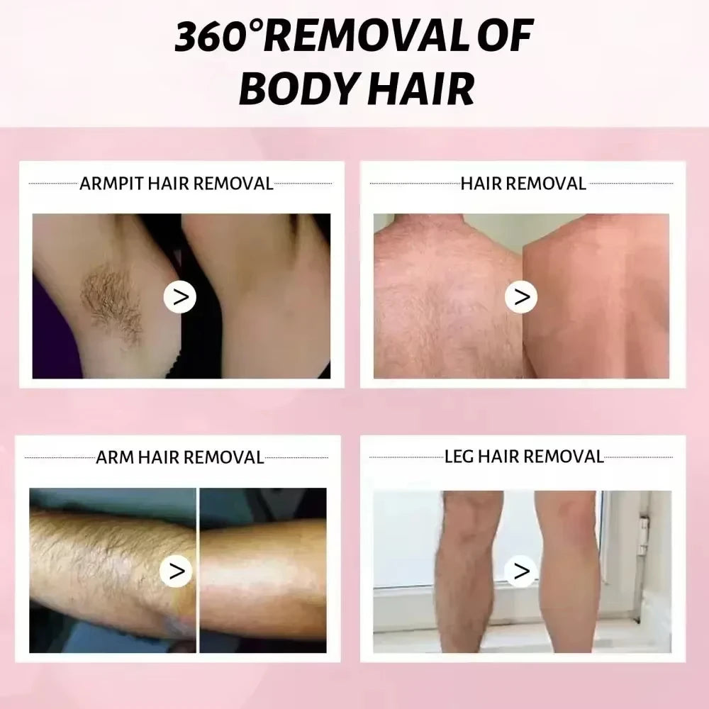Permanent Hair Inhibition Serum Painless Allantoin Lupine Essence Hair Remover Hair Growth Inhibitor Depilatory Body Cream Care