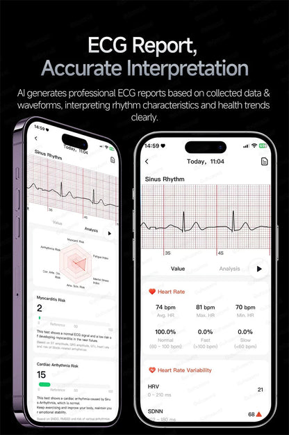 Smartwatch ECG High-End dla mężczyzn Ciśnienie krwi Lipidy Tlen we krwi Analiza ciała Kwas moczowy Monitor Zdrowia Smartwatch dla mężczyzn i kobiet