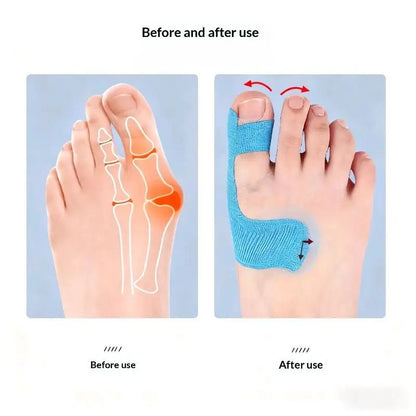 20PCS Bunion Corrector & Pain Relief Kinesiology Athletic Tape For Bunions & Turf Toe,Big Toe Spacer/Separator/Straightener Tape