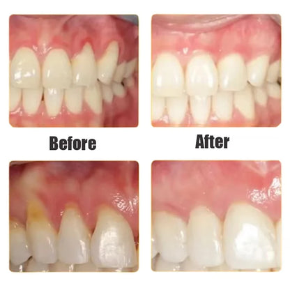 Damaged Gum Repair Care Gel Serum Relieve Sore Gums Allergy Deep Cleaning Teeth Stains Tartar Serum Dental Caries Tooths Serum