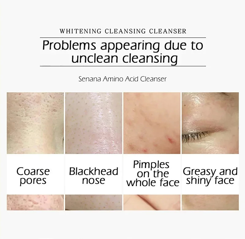 Nicotinamide Amino Acid Face Cleanser Facial Scrub Cleansing Acne Oil Control Blackhead Remover Shrink Pores Skin Care