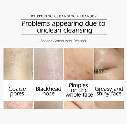 Nicotinamide Amino Acid Face Cleanser Facial Scrub Cleansing Acne Oil Control Blackhead Remover Shrink Pores Skin Care