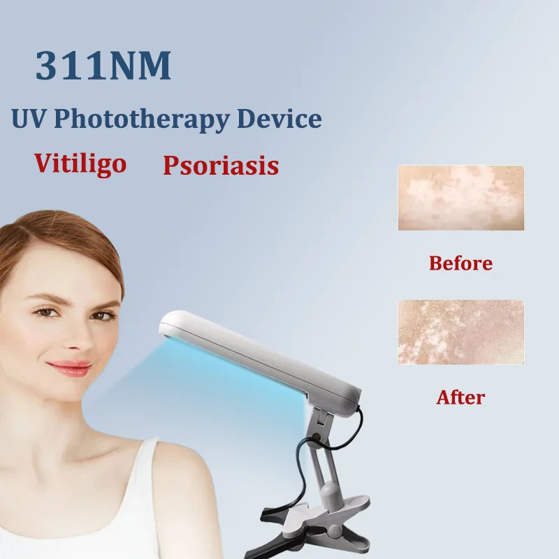 311NM UVB Phototherapy Lamp Device for Vitiligo Treatment UV NarrowBand Ultraviolet Light Therapy Psoriasis Spots Eczema