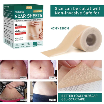 Z. 1 Roll Silicone Scar Sheets Gel Scar Patch 4cmX150cm Self-Adhesive Scar Cover Tape Reusable And Effective Skin Care Strips