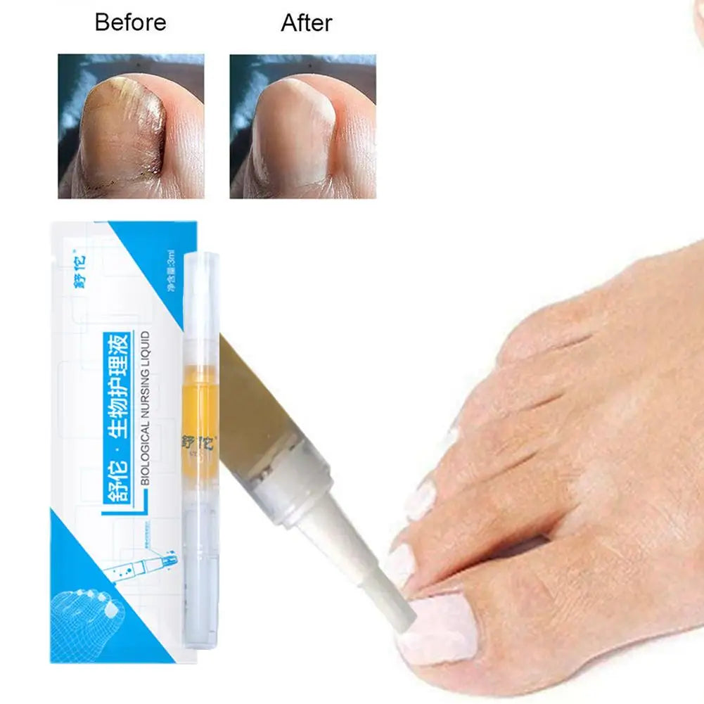 High-end Nail Care Pen Toenail Repair Pen With Natural Ingredients Nail Beauty Health Nail Repair Essence Gentle Care Tool