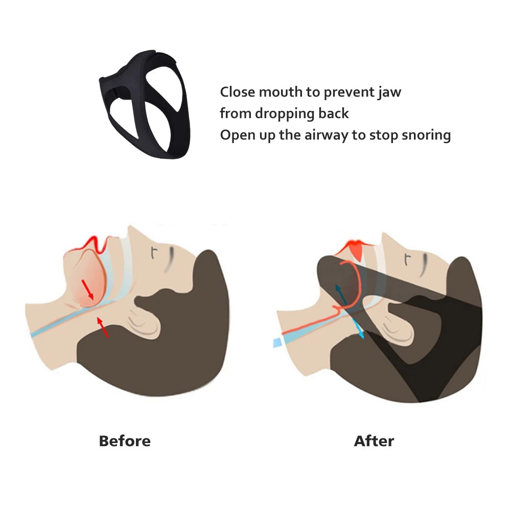 1pcs Anti Snore Chin Strap,Anti-Dry Mouth Chin Strap For CPAP Users, Stop Snoring, Snoreless Sleeping Solution For Men And Women