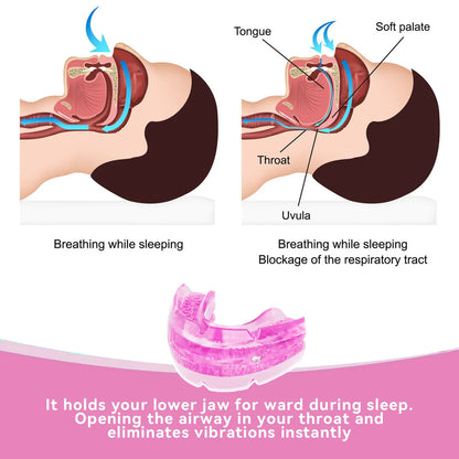 Anti Snoring Mouth Guard Improve Sleeping Adjustable Snoring Mouth Guard Anti-Apnea Teeth Bruxism Stop Snoring Device Mouthpiece
