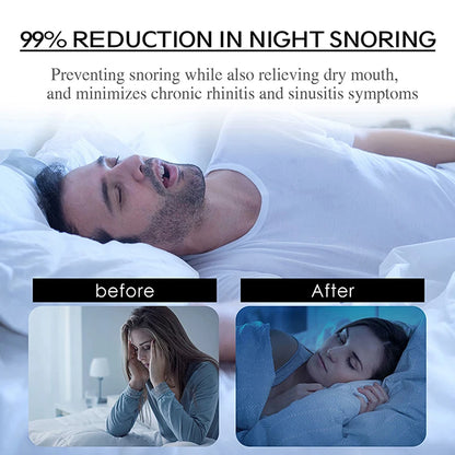 30Pcs Anti Snoring Sleep Mouth Tape Best Breathing Nasal Strips Medical Grade Improved Sleeping Keep Mouth Close Prevent Snoring
