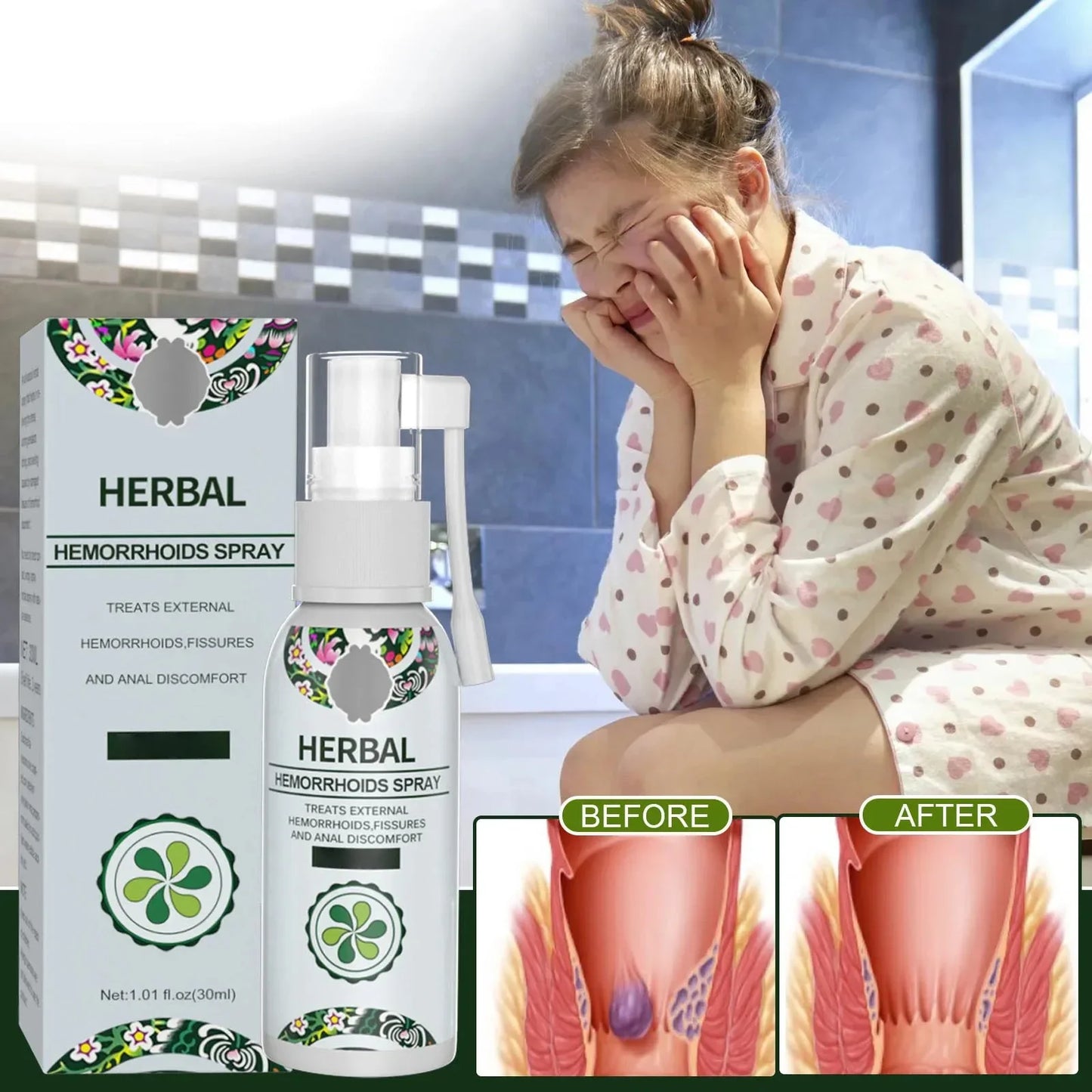 EELHOE  Hemorrhoid Treatment Spray Health Skin Care Natural Anal Herbal Internal Piles External Anal Fissure Anal Relief Spray